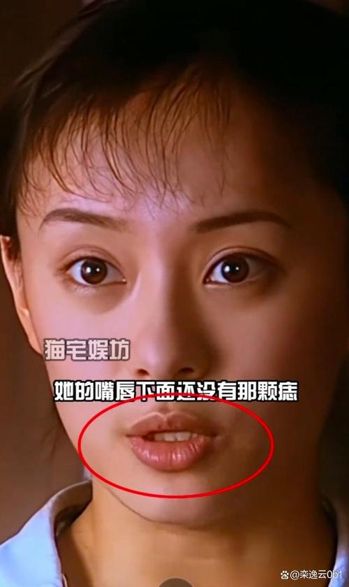 管家婆免费版和孙俪唇下痣没了与孙俪嘴唇的痣
