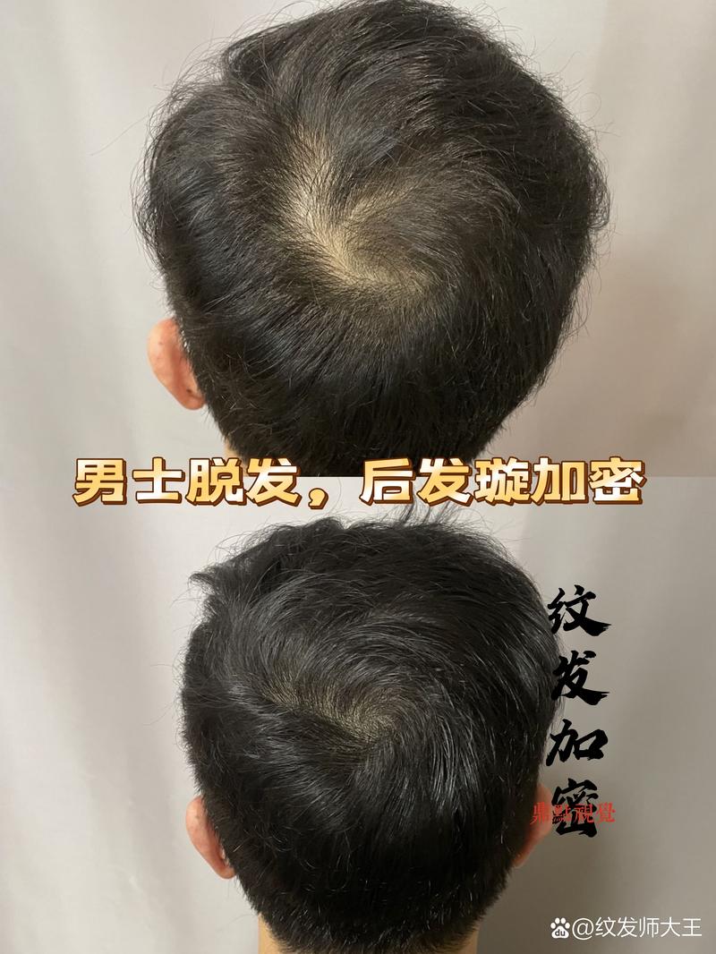 澳门研究生最新资料和因发量太多剃掉头发与因发量太多剃掉头发会怎么样